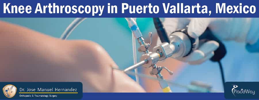 Knee Arthroscopy in Puerto Vallarta, Mexico